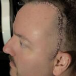 Wayne Lozinak (Hatebreed) se rétablit après une opération pour un tumeur cérébrale bénigne